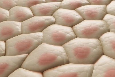  "النخالة الوردية" أشكالها وطرق علاجها 