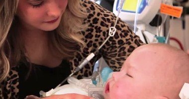 جهاز مطبوع بتقنية ثلاثية الأبعاد لمساعدة طفل على التنفس